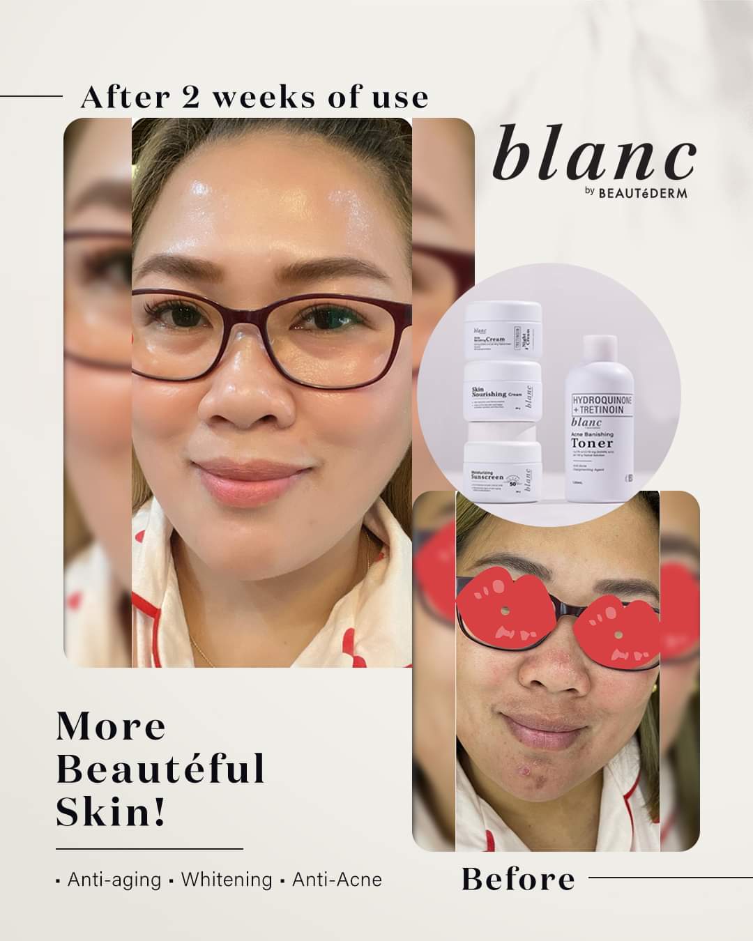 Buy 1 Take 1 Blanc Regular Set