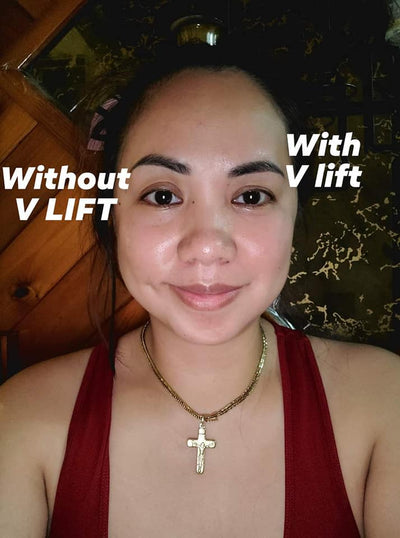 Buy 1 Take 1 Beautederm VLift RF Machine