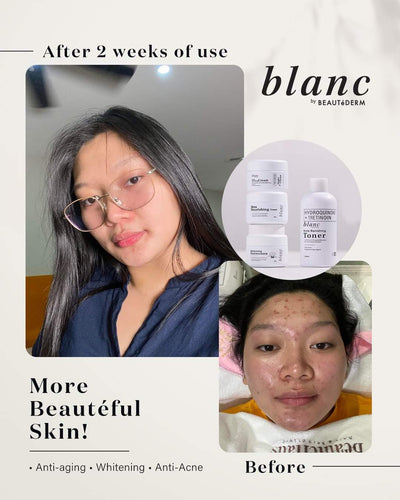 Buy 1 Take 1 Blanc Regular Set