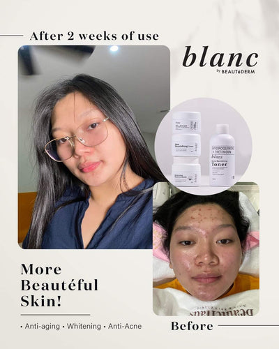 Blanc - Acne Banishing Cream 20g